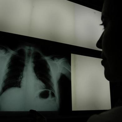 *** Pneumonia-RicardoW ***Doenças Respiratórias,PneumoniaMédica analiza um raio X.De um pulmão no hospital Pompéia