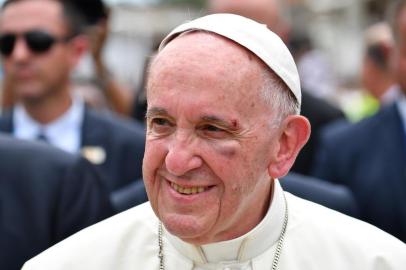  

Pope Francis, showing a bruise around his left eye and eyebrow caused by an accidental hit against the popemobile's window glass while visiting the old sector of Cartagena,Colombia, is greeted by faithful on September 10, 2017.
Nearly 1.3 million worshippers flocked to a mass by Pope Francis on Saturday in Medellin, the Colombian city known as the stronghold of the late drug lord Pablo Escobar. / AFP PHOTO / Alberto PIZZOLI

Editoria: REL
Local: Cartagena
Indexador: ALBERTO PIZZOLI
Secao: religious leader
Fonte: AFP
Fotógrafo: STF