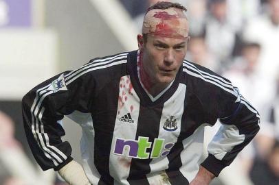 ALAN SHEARER GOLEADOR DO NEWCASTLE.
Newcastles Alan Shearer wears a bandage on his head during the English Premier league soccer match against Aston Villa in Newcastle, England, Monday, April 21, 2003.  (AP Photo/Owen Humphreys/PA) **  UNITED KINGDOM OUT: MAGAZINES OUT: NO SALES: ONLINE OUT: INTERNET OUT **
#PÁGINA:53
 Fonte: AP
 Fotógrafo: OWEN HUMPHREYS