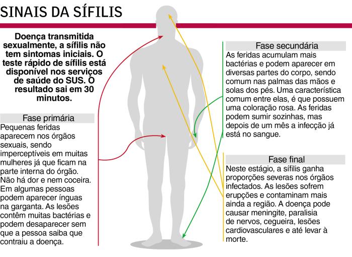 gráfico / Agência RBS