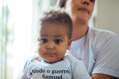  PORTO ALEGRE, RS, BRASIL, 11/01/2018 : Samuel Soares dos Santos, dois anos, tem Síndrome de Berdon e precisa de um transplante multivisceral. Família corre contra o tempo com campanha para conseguir os R$ 7 milhões necessários da cirurgia. Fotos dele com os pais Joseli Alves dos Santos e José Soares, no apartamento onde vivem em Porto Alegre.  (Omar Freitas/Agência RBS)Indexador: Omar Freitas