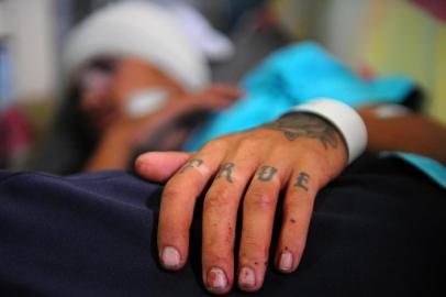  CAXIAS DO SUL, RS, BRASIL 19-02-2018Leandro Machado, 19 anos, foi espancado por um grupo de jovens na noite de domingo após uma festa de carnaval no centro de Caxias do Sul. (Felipe Nyland/Agência RBS)