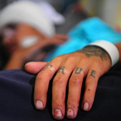  CAXIAS DO SUL, RS, BRASIL 19-02-2018Leandro Machado, 19 anos, foi espancado por um grupo de jovens na noite de domingo após uma festa de carnaval no centro de Caxias do Sul. (Felipe Nyland/Agência RBS)