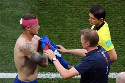 Icelands defender Ragnar Sigurdsson changes his jersey with his head bandaged after getting injured during the Russia 2018 World Cup Group D football match between Nigeria and Iceland at the Volgograd Arena in Volgograd on June 22, 2018. / AFP PHOTO / Philippe DESMAZES / RESTRICTED TO EDITORIAL USE - NO MOBILE PUSH ALERTS/DOWNLOADS