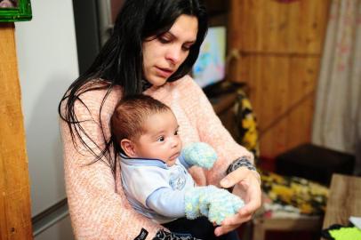  CAXIAS DO SUL, RS, BRASIL, 16/07/2018. Mãe denuncia negligência médica na hora do parto, realizado no Hospital Geral de Caxias do Sul. Natália Ribeiro da Silva, 22 anos, teve Waysler Ediel da Silva Kinast de parto normal, apesar de pedir por cesárea. Waysler teve a clavícula quebrada e, mesmo com fisioterapia, não recuperou os movimentos do braço direito. (Diogo Sallaberry/Agência RBS)