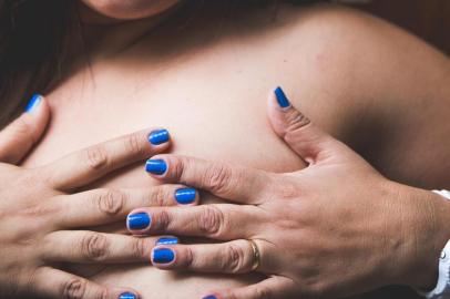  FLORIANÓPOLIS, SC, BRASIL, 20-10-2015 - Gisele Toledo passou pelo diagnóstico de câncer de mama, fez cirurgia, quimioterapia, radioterapia e agora está em fase de cirurgias para a reconstrução de seu seio.