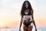 Winnie Harlow critica: “Parem de dizer que eu ‘sofro’ de vitiligo”