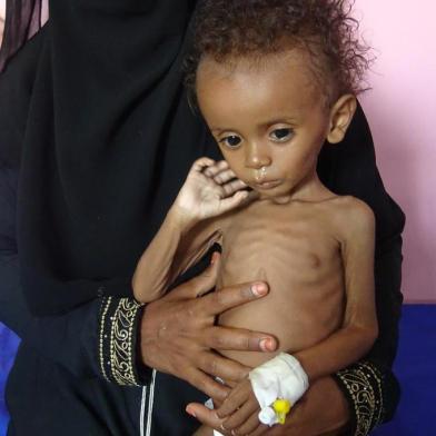 A Yemeni mother holds her malnourished child as they wait for treatments in a medical centre in the village of Al Mutaynah, in the Tuhayta province, western Yemen, on November 29, 2018. - According to the World Health Organization, nearly 10,000 people have been killed since the Saudi-backed coalition launched an offensive against Huthi rebels in March 2015, though some rights groups estimate the toll could be five times higher. (Photo by - / AFP)