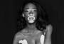 Winnie Harlow será a primeira modelo com vitiligo a desfilar pela Victoria's Secret