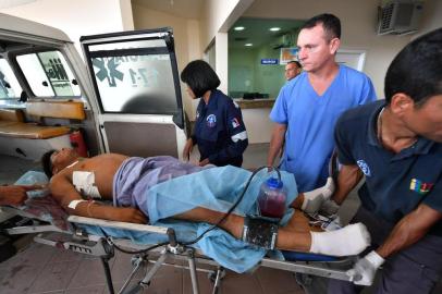  An indigenous man injured during clashes with Venezuelan soldiers, arrives at the hospital in Boa Vista, Roraima State, Brazil, on February 22, 2019. - Venezuelan soldiers killed two people and wounded 15 others when they tried to prevent the troops from blocking an entry route for humanitarian aid on the Brazilian border, a human rights groups said Friday. An indigenous woman and her husband were killed and at least 15 other members of the Pemon indigenous community were injured, said the group, Kape Kape. (Photo by Nelson ALMEIDA / AFP)Editoria: WARLocal: Boa VistaIndexador: NELSON ALMEIDASecao: crisisFonte: AFPFotógrafo: STF