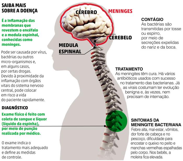 Arte-Zero Hora / Agência RBS