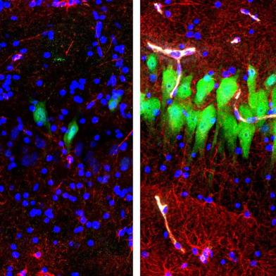  A handout photo made available on April 17, 2019 by the Nature press service shows immunofluorescent stains for neurons (green), astrocytes (red), and cell nuclei (blue) in the hippocampal CA3 region of the brain which was either left untreated for 10 hours after death (left) or subjected to perfusion with the BrainEx technology (right) as a new study reviels that scientists managed to preserve brain function in pigs, 10 hours after they had their heads chopped off. - Scientists have managed to restore cell function in the brains of pigs hours after they died, in a breakthrough on April 17, 2019 that experts said threw into question the very notion of what makes animals -- or even humans -- alive. (Photo by Stefano G. DANIELE and Zvonimir VRSELJA / NATURE PUBLISHING GROUP / AFP) / RESTRICTED TO EDITORIAL USE - MANDATORY CREDIT AFP PHOTO / NATURE PUBLISHING GROUP / Sestan Laboratory / Yale School of Medicine / Stefano G. Daniele & Zvonimir Vrselja- NO MARKETING NO ADVERTISING CAMPAIGNS - DISTRIBUTED AS A SERVICE TO CLIENTS - NO ARCHIVE / Editoria: SCILocal: ParisIndexador: STEFANO G. DANIELESecao: natural scienceFonte: NATURE PUBLISHING GROUPFotógrafo: STR