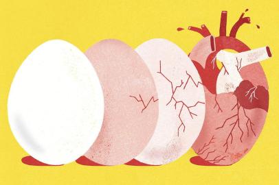 Researchers found that eating as little as one-half an egg a day could increase a personâ¿¿s risk of heart disease, stroke and premature death.Researchers found that eating as little as one-half an egg a day could increase a personâs risk of heart disease, stroke and premature death. (Gracia Lam/The New York Times) -- NO SALES; FOR EDITORIAL USE ONLY WITH NYT STORY SCI BRODY HEALTH BY JANE E. BRODY FOR APRIL 23, 2019. ALL OTHER USE PROHIBITED. --Editoria: ALocal: UNDATEDIndexador: GRACIA LAMFonte: NYTNSFotógrafo: STR