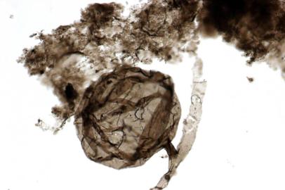 A microfossil of Ourasphaira giraldae â¿¿ the oldest fungus fossil ever found, scientists say.An undated photo provided by C.C. Loron, a graduate student at the University of LiÃ¨ge, shows a microfossil of Ourasphaira giraldae â the oldest fungus fossil ever found, scientists say. Microscopic fossils from the Arctic hint that fungi reached land long before plants. (C.C.Loron/University of Liège via The New York Times) â NO SALES; FOR EDITORIAL USE ONLY WITH NYT STORY SCI FUNGUS FOSSIL BY CARL ZIMMER FOR MAY 28, 2019. ALL OTHER USE PROHIBITED. âEditoria: ALocal: UNDATEDIndexador: C.C.LORON/UNIVERSITY OF LIÃ¿GEFonte: C.C.LORON/UNIVERSITY OF LIÃ¿GEFotógrafo: HO