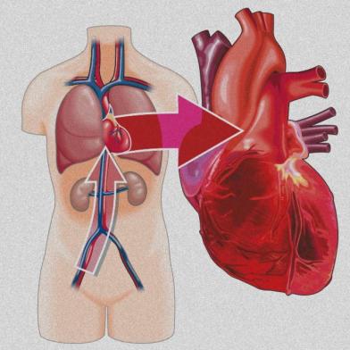 +Saúde, angioplastia, cateterismo