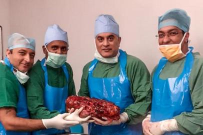 In this handout photograph taken on October 29, 2019 and released by Sir Ganga Ram Hospital on November 25, 2019, hospital staff members pose for photographs as they hold a diseased kidney after a surgery in Sir Ganga Ram Hospital in New Delhi. - Indian surgeons have cut a kidney weighing the same as two new-born babies out of a man with a life-threatening genetic condition, a surgeon said on November 25. The 7.4 kilogramme (16.3 pound) kidney is one of the biggest ever removed in an operation. (Photo by Handout / Sir Ganga Ram Hospital / AFP) / RESTRICTED TO EDITORIAL USE - MANDATORY CREDIT AFP PHOTO / Sir Ganga Ram Hospital - NO MARKETING NO ADVERTISING CAMPAIGNS - DISTRIBUTED AS A SERVICE TO CLIENTS --- NO ARCHIVE ---