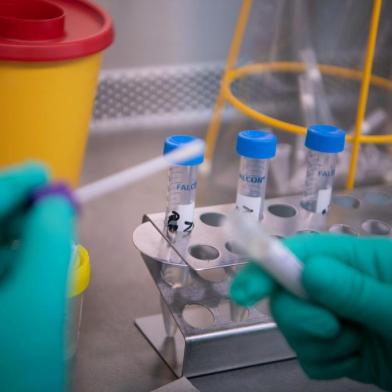  A laborant at the State Health Authorities of Baden-Wuerttemberg works on a test sample of a  suspected case of the 2019 Novel Coronavirus (2019-nCoV) in Stuttgart, sothern Germany on January 29, 2020. - Germanys first confirmed coronavirus patient caught the disease from a Chinese colleague who visited Germany last week, officials said on January 28, 2020, in the first human-to-human transmission on European soil, according to an AFP tally. (Photo by Marijan Murat / dpa / AFP) / Germany OUTEditoria: HTHLocal: StuttgartIndexador: MARIJAN MURATSecao: healthcare policyFonte: dpaFotógrafo: STR