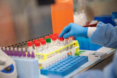 LAKE SUCCESS, NY - MARCH 11: A lab technician begins semi-automated testing for COVID-19 at Northwell Health Labs on March 11, 2020 in Lake Success, New York. An emergency use authorization by the FDA allows Northwell to move from manual testing to semi-automated.   Andrew Theodorakis/Getty Images/AFP<!-- NICAID(14447673) -->