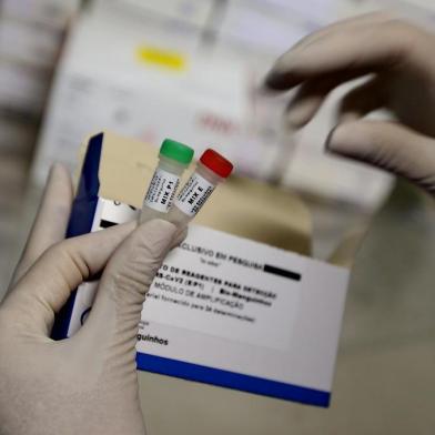  PORTO ALEGRE, RS, BRASIL, 09/03/2020- Exames Coronavirus. Funcionamento dos kit para testes do coronavírus.(FOTOGRAFO: LAURO ALVES / AGENCIA RBS)