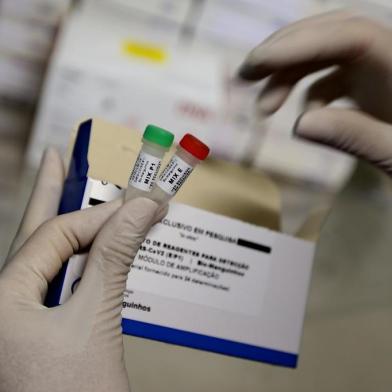 PORTO ALEGRE, RS, BRASIL, 09/03/2020- Exames Coronavirus.Equipe do Laboratório Central de Saúde Pública do Rio Grande do Sul (Lacen). Funcionamento dos kit para testes do coronavírus.(FOTOGRAFO: LAURO ALVES / AGENCIA RBS)<!-- NICAID(14445454) -->