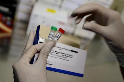 PORTO ALEGRE, RS, BRASIL, 09/03/2020- Exames Coronavirus.Equipe do Laboratório Central de Saúde Pública do Rio Grande do Sul (Lacen). Funcionamento dos kit para testes do coronavírus.(FOTOGRAFO: LAURO ALVES / AGENCIA RBS)<!-- NICAID(14445454) -->