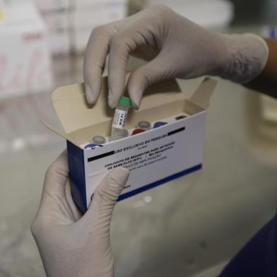 PORTO ALEGRE, RS, BRASIL, 09/03/2020- Exames Coronavirus.Equipe do Laboratório Central de Saúde Pública do Rio Grande do Sul (Lacen). Funcionamento dos kit para testes do coronavírus.(FOTOGRAFO: LAURO ALVES / AGENCIA RBS)<!-- NICAID(14445453) -->