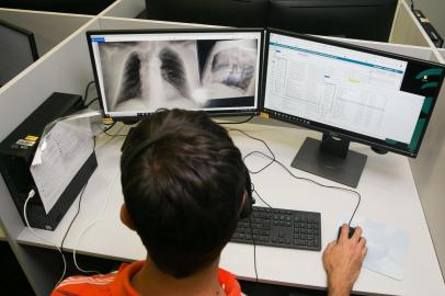  PORTO ALEGRE, RS, BRASIL, 04/02/2019 -  Foto do Núcleo de Telessaúde da UFRGS. Nova resolução do Conselho Federal de Medicina (CFM) sobre telemedicina prevê que médicos poderão realizar consultas, diagnósticos, cirurgias e outros atendimentos a distância, por meio da internet. (FOTO: ANDRÉA GRAIZ / AGENCIA RBS)<!-- NICAID(13943902) -->