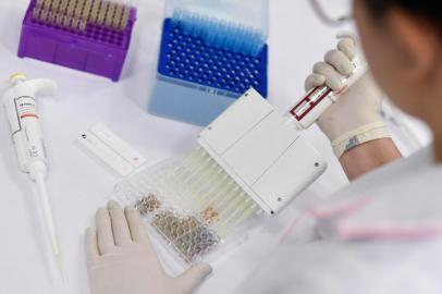  (FILES) In this file photo taken on March 26, 2020 A researcher works on the diagnosis of suspected coronavirus COVID-19 cases in Belo Horizonte, state of Minas Gerais, Brazil. - Brazil is in the forefront of vaccines for the new coronavirus, testing in large scale and preparing for the production of millions of dosis. On the other hand from Europe of China, the virus is expanding in the country which is second in the world in number of cases after the United States, an ideal situation to test the effectivity of a vaccine. (Photo by Douglas MAGNO / AFP)Editoria: HTHLocal: Belo HorizonteIndexador: DOUGLAS MAGNOSecao: diseaseFonte: AFPFotógrafo: STR<!-- NICAID(14541690) -->