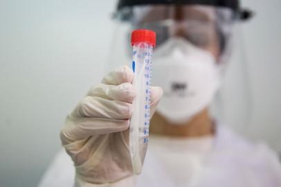  PORTO ALEGRE, RS, BRASIL, 03-09-2020: Teste swab ou pcr da tecnica em enfermagem, Clair Soares Nascente, durante consulta e exames no Centro de Pesquisas Clinicas do Hospital Sao Lucas, da Pucrs, para receber a segunda dose da vacina CoronaVac. A profissional da saude e uma das voluntarias para testar a vacina contra o coronavirus. (Foto: Mateus Bruxel / Agencia RBS)Indexador: Mateus Bruxel<!-- NICAID(14584367) -->