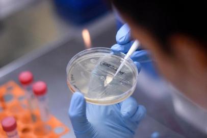  (FILES) In this file photo taken on March 26, 2020 A researcher works on the development of a vaccine against the new coronavirus COVID-19, in Belo Horizonte, state of Minas Gerais, Brazil. - Brazil is in the forefront of vaccines for the new coronavirus, testing in large scale and preparing for the production of millions of dosis. On the other hand from Europe of China, the virus is expanding in the country which is second in the world in number of cases after the United States, an ideal situation to test the effectivity of a vaccine. (Photo by DOUGLAS MAGNO / AFP)Editoria: HTHLocal: Belo HorizonteIndexador: DOUGLAS MAGNOSecao: diseaseFonte: AFPFotógrafo: STR<!-- NICAID(14541689) -->