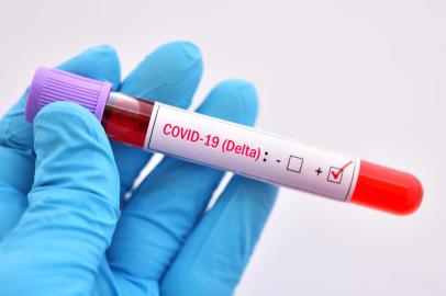 Delta variant COVID-19 positive, blood sample tube positive with delta variant or Indian strain COVID-19 Fonte: 440099997<!-- NICAID(14820520) -->