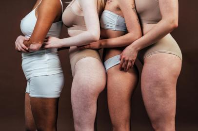 Group of multiethnic women with different kind of skin posing together in studio. Concept about body positivity and self acceptanceIndexador: margarita gangaloFonte: 415817220<!-- NICAID(14824440) -->