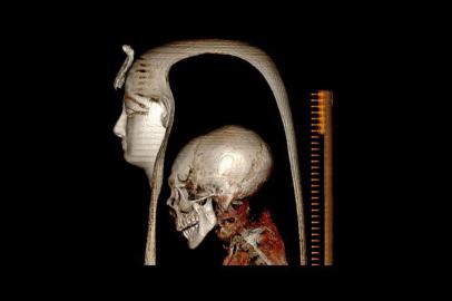 Uma imagem de apostila divulgada pelo Ministério de Antiguidades egípcio em 28 de dezembro de 2021 mostra uma reconstrução 3D da cabeça de Amenhotep I, criada por tomografia computadorizada (TC). - O Egito desembrulhou digitalmente a múmia do famoso Faraó Amenhotep I revelando seus segredos sem perturbar sua máscara funerária pela primeira vez desde que foi descoberta em 1881. Graças às imagens digitais 3D avançadas, os pesquisadores descobriram novas técnicas de mumificação usadas para o faraó cujo governo remonta a mais de 1.500 aC. (Foto: Ministério de Antiguidades Egípcio / AFP) / === RESTRITO PARA USO EDITORIAL - CRÉDITO OBRIGATÓRIO FOTO AFP / HO / MINISTÉRIO EGÍPCIO DAS ANTIQUIDADES - SEM MARKETING SEM CAMPANHAS DE PUBLICIDADE - DISTRIBUÍDO COMO UM SERVIÇO AOS CLIENTES ==<!-- NICAID(14978179) -->