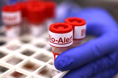 SEATTLE, WA - JULY 12: The top of a swab specimen containing Monkeypox virus is labeled Bio Alert at the UW Medicine Virology Laboratory on July 12, 2022 in Seattle, Washington. The UW Medicine Virology Laboratory is one of a handful of clinical reference labs in the country to offer laboratory-developed PCR tests for the detection of Monkeypox virus.   Karen Ducey/Getty Images/AFP (Photo by Karen Ducey / GETTY IMAGES NORTH AMERICA / Getty Images via AFP)<!-- NICAID(15155676) -->