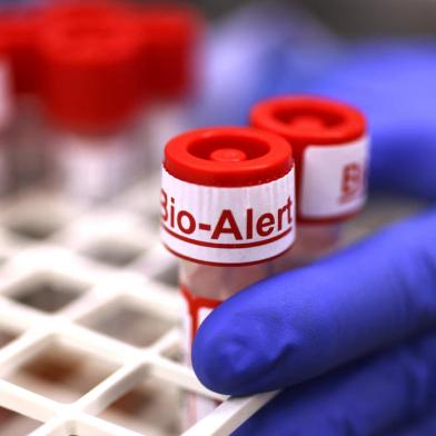 SEATTLE, WA - JULY 12: The top of a swab specimen containing Monkeypox virus is labeled Bio Alert at the UW Medicine Virology Laboratory on July 12, 2022 in Seattle, Washington. The UW Medicine Virology Laboratory is one of a handful of clinical reference labs in the country to offer laboratory-developed PCR tests for the detection of Monkeypox virus.   Karen Ducey/Getty Images/AFP (Photo by Karen Ducey / GETTY IMAGES NORTH AMERICA / Getty Images via AFP)<!-- NICAID(15155676) -->