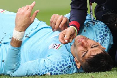 Irans goalkeeper #01 Alireza Beiranvand receives medical attention following a crash of heads with Irans defender #19 Majid Hosseini during the Qatar 2022 World Cup Group B football match between England and Iran at the Khalifa International Stadium in Doha on November 21, 2022. (Photo by Fadel Senna / AFP)<!-- NICAID(15271344) -->