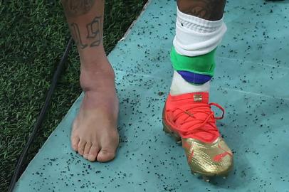 Picture of the swollen ankle of Brazils forward #10 Neymar taken as he leaves the field at the end of the Qatar 2022 World Cup Group G football match between Brazil and Serbia at the Lusail Stadium in Lusail, north of Doha on November 24, 2022. (Photo by Giuseppe CACACE / AFP)Editoria: SPOLocal: DohaIndexador: GIUSEPPE CACACESecao: soccerFonte: AFPFotógrafo: STF<!-- NICAID(15275766) -->