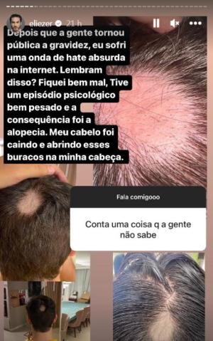 Reprodução / @eliezer Instagram